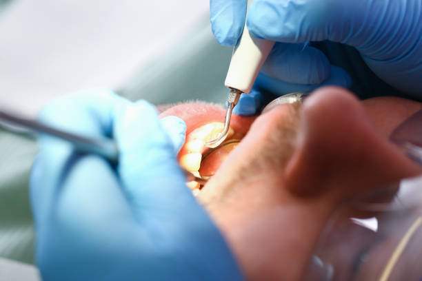 Best Mobile Emergency Dentist in Underwood Petersville, AL