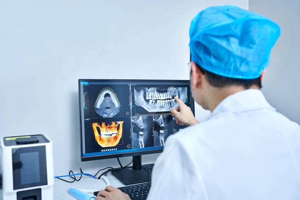 Best Emergency Dentist for Lost Fillings or Crowns in Underwood Petersville, AL