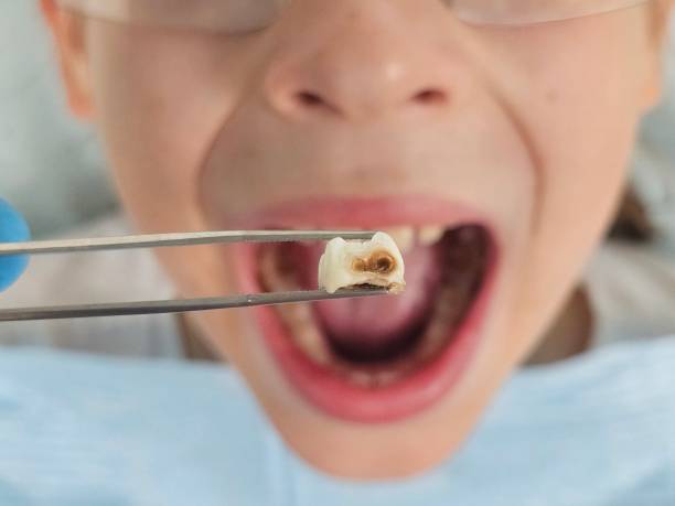 Best Emergency Dental Services for Seniors in Underwood Petersville, AL