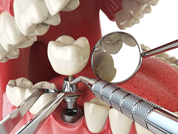Best Weekend Emergency Dentist in Underwood Petersville, AL